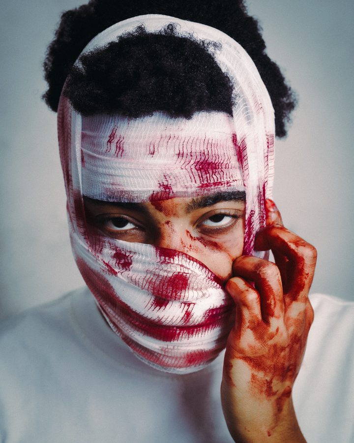 Skin
