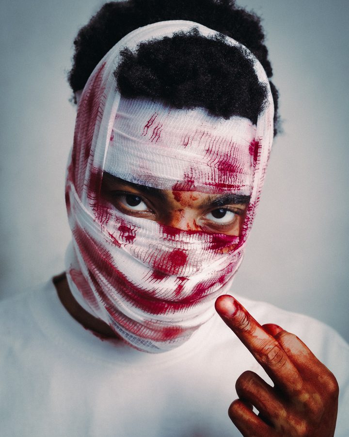 Skin